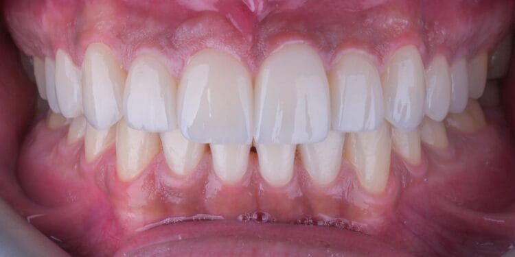 gülüş tasarımı ankara