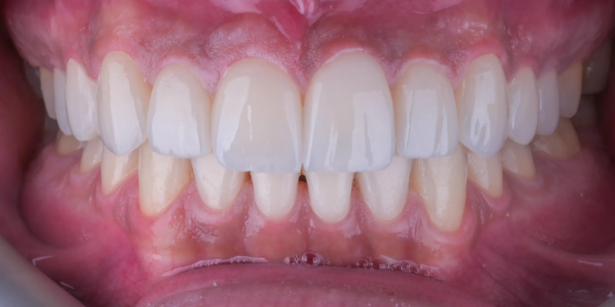 gülüş tasarımı ankara