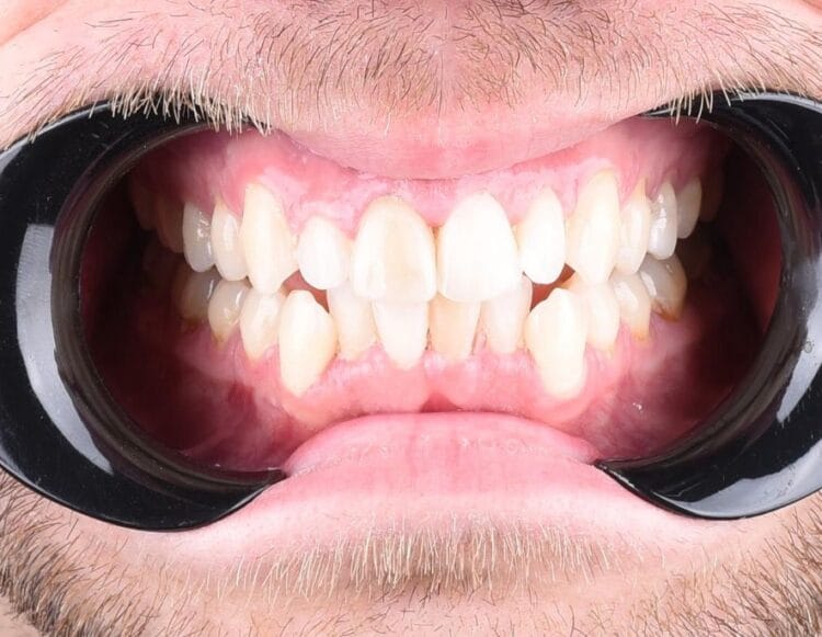 dijital gülüş tasarımı